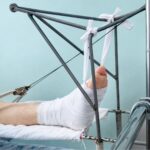 Упал с крыши и сломал пятки житель Петропавловска