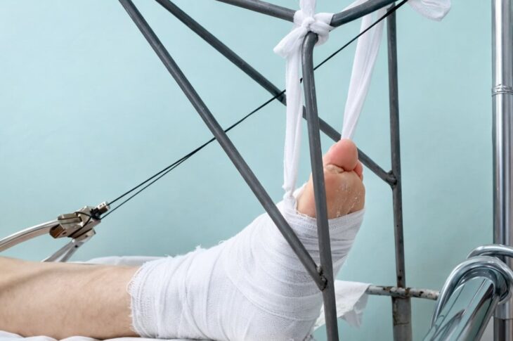 Упал с крыши и сломал пятки житель Петропавловска